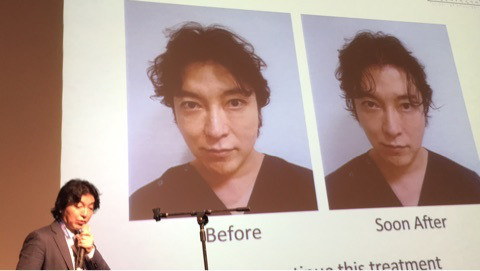 {94315893-6823-472E-BABD-9B435DD78D37}