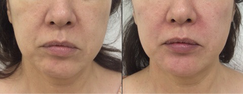 {15A8CCA9-EA39-4BB0-AC94-0A838F8E8E57}