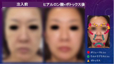 {B28C3FE1-1C23-4029-9030-E3935E5E8D89}